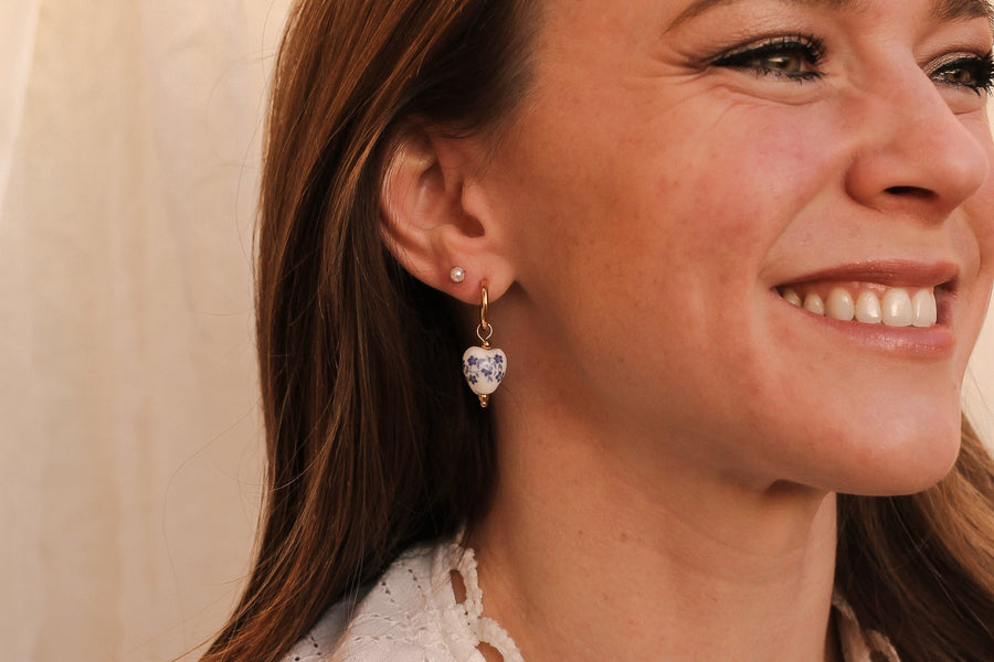Why Jewelry Metals Matter